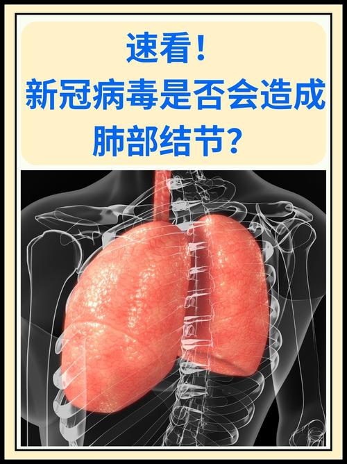 疫情快报最新,疫情速报最新数据-第3张图片 疫情快报最新,疫情速报最新数据-第3张图片